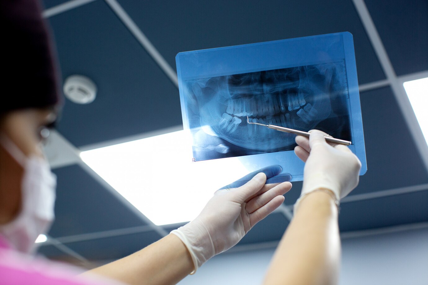 Dental X-rays