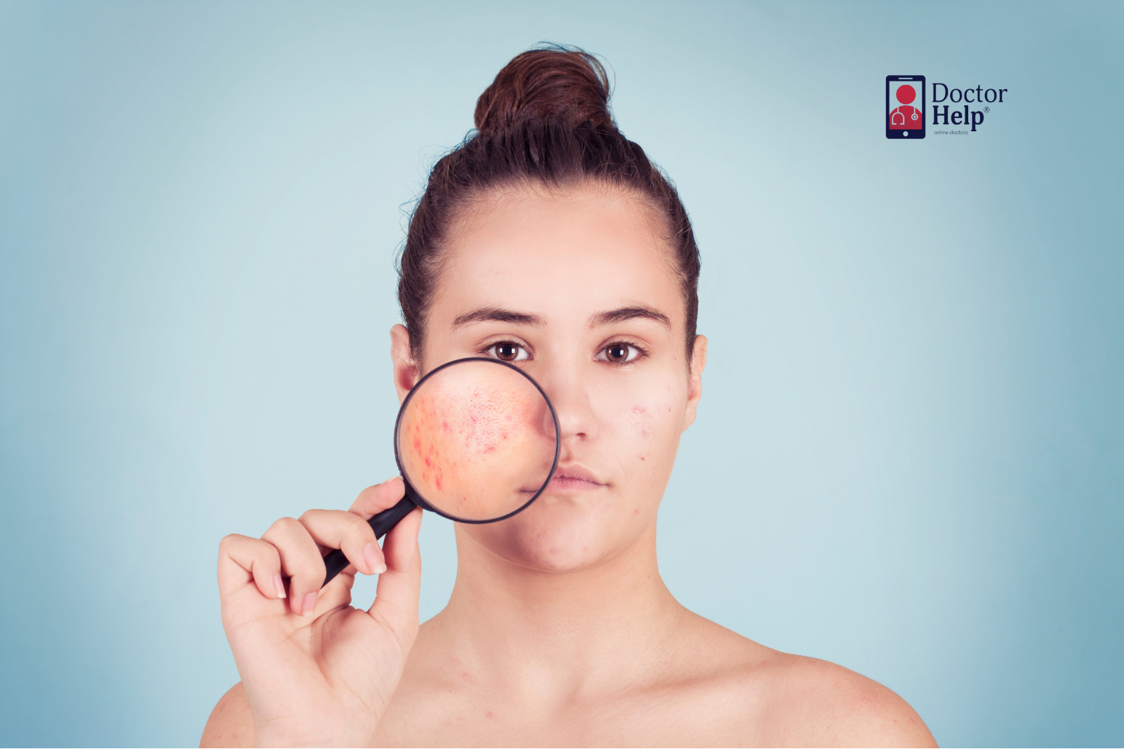 Acne Treatment