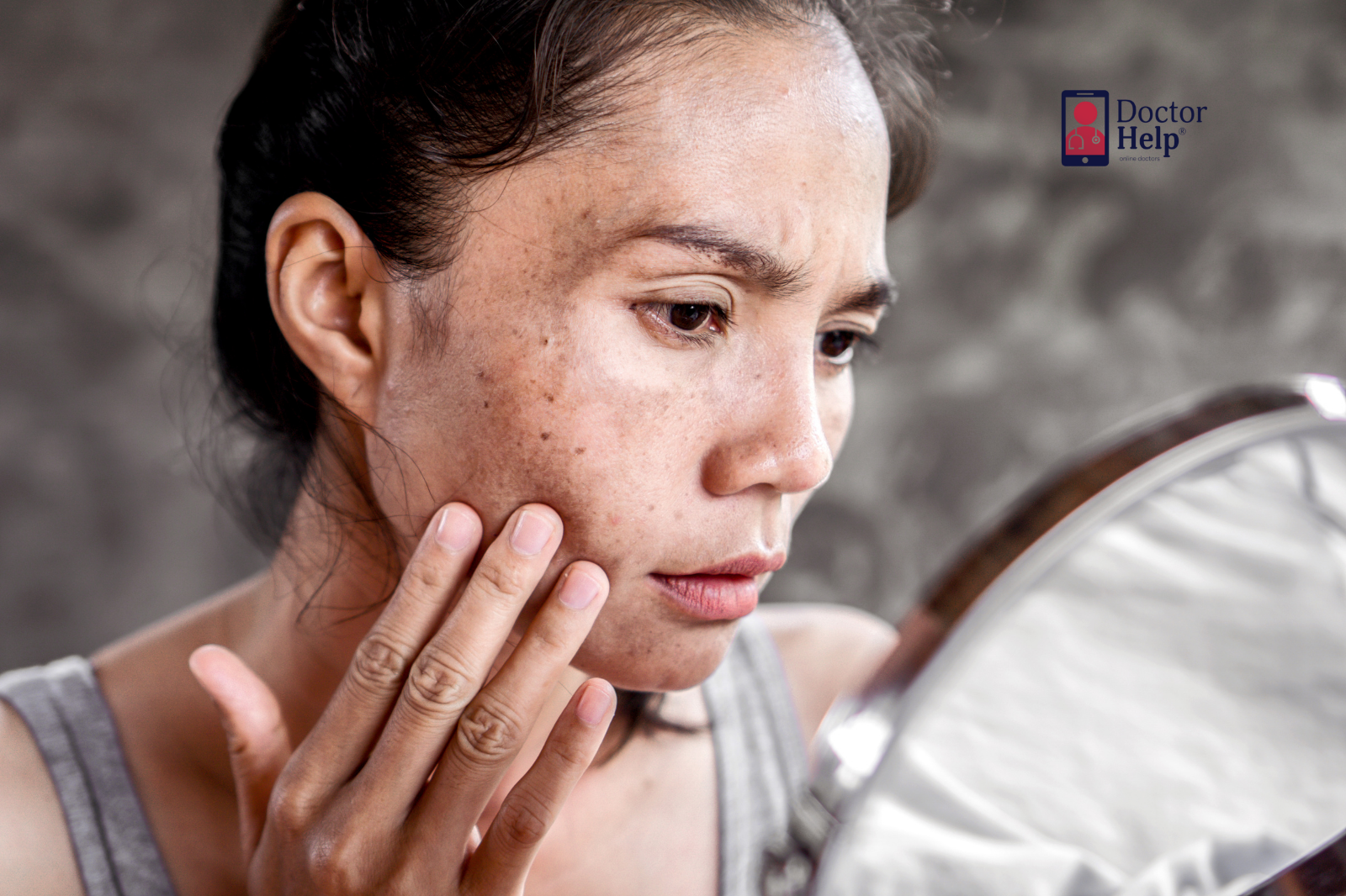 Skin Conditions