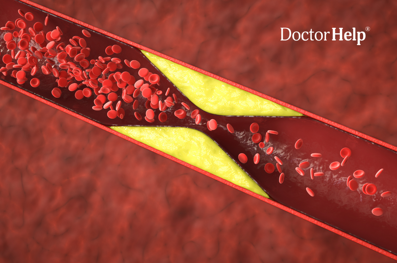 Understanding Cholesterol