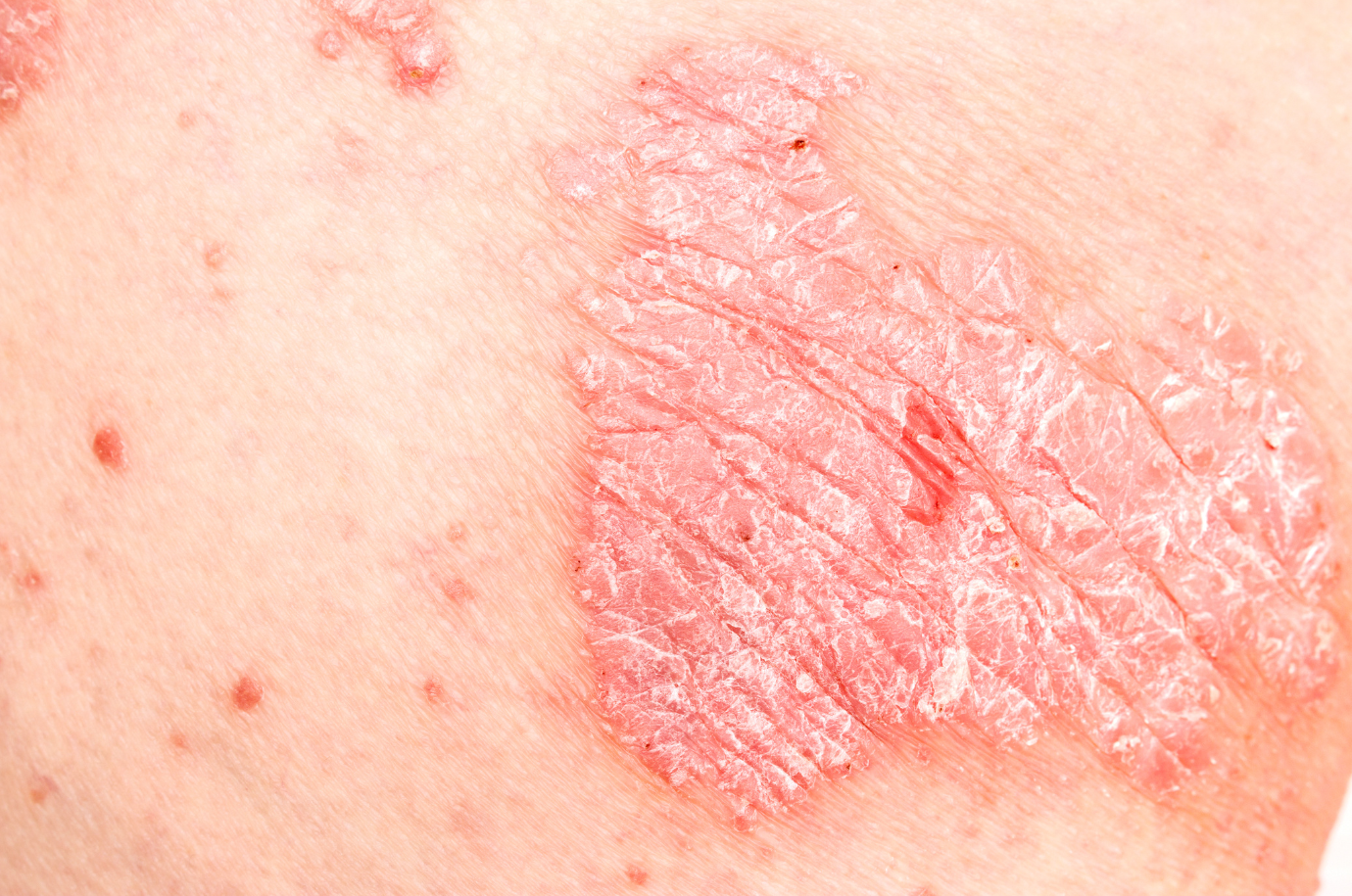 Skin Conditions Treatment​