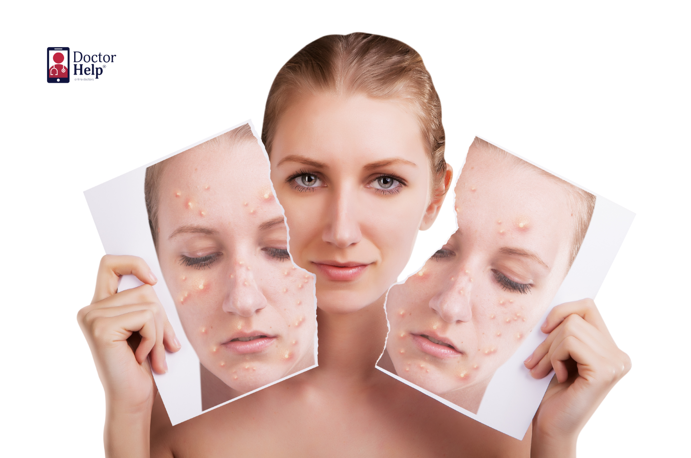 Take Action Clear Skin Awaits​