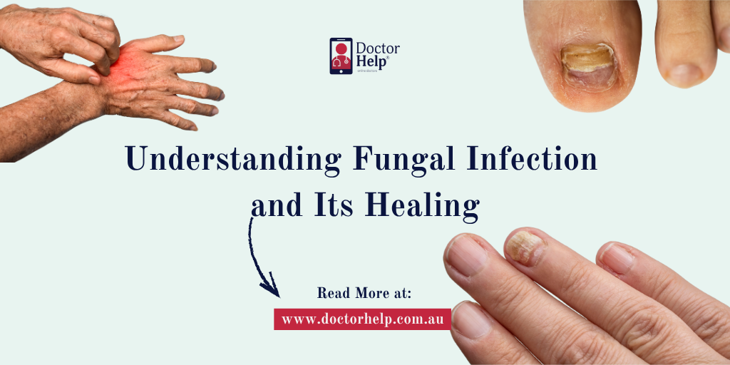 Fungal Infection